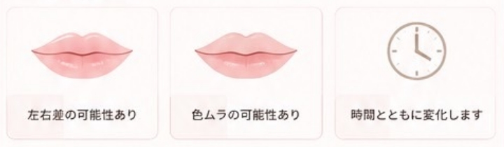 左右差の可能性あり、色ムラの可能性あり、時間とともに変化します
