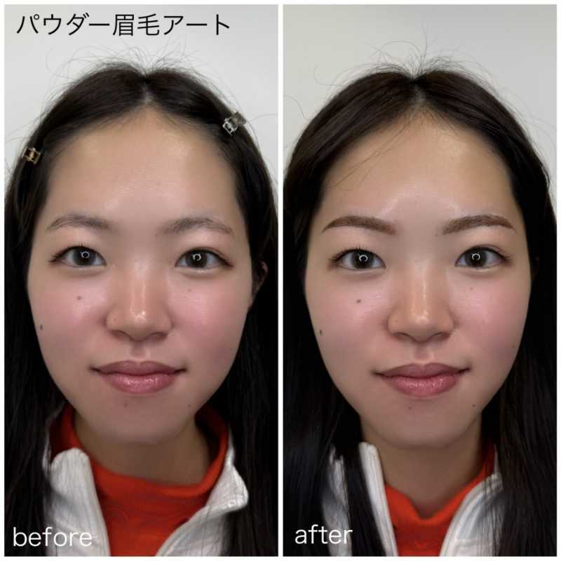 パウダー眉毛アートの施術前と施術後